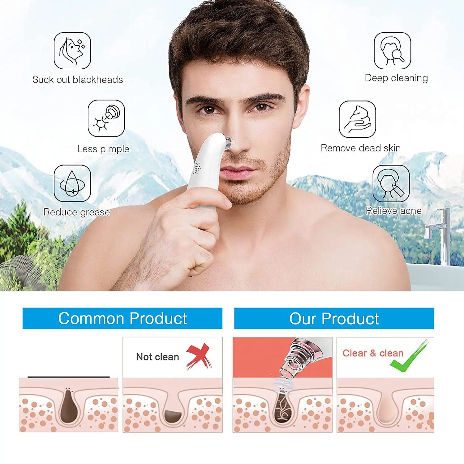 20X Microscope App Visual blackhead remover 2021 Replaceable blackhead remover vacuum with camera