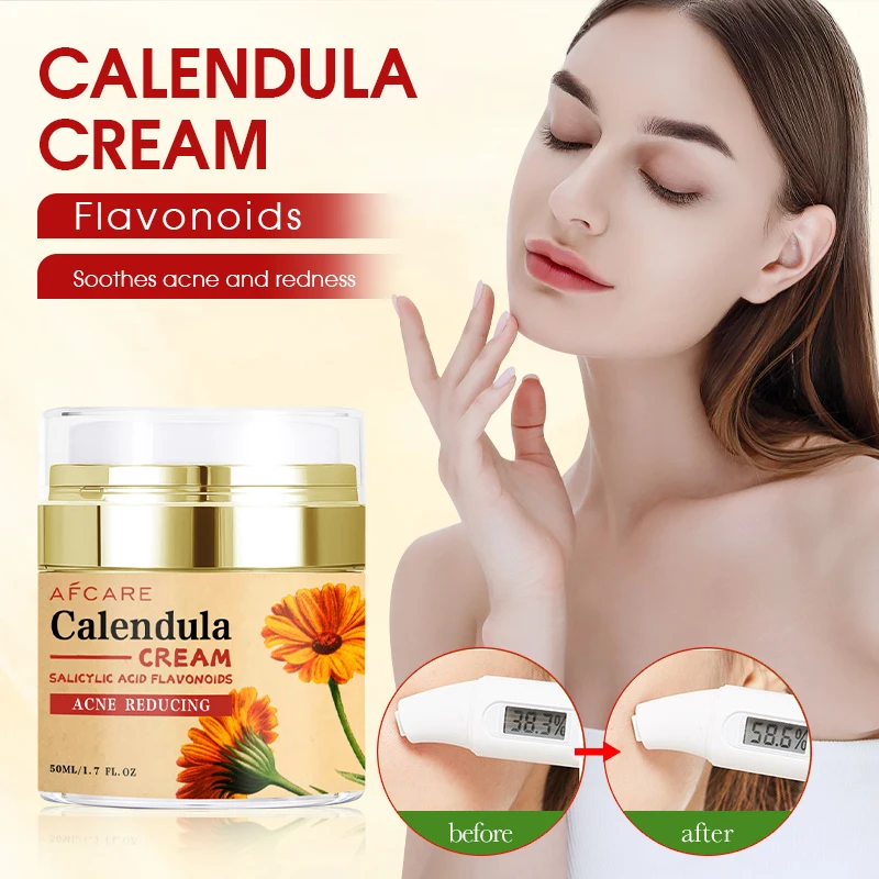 Chinese Brand Face Cream Paraben-free Repair Nourishing & Hyaluronic acid & Calendula Face Cream for Whitening and Acne