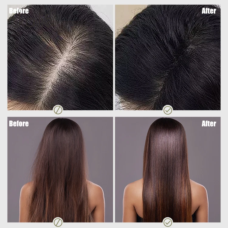 Hair Thickening Serum Nourishing Daily Scalp Tonic Increase Hair Density Hair Growth Serum