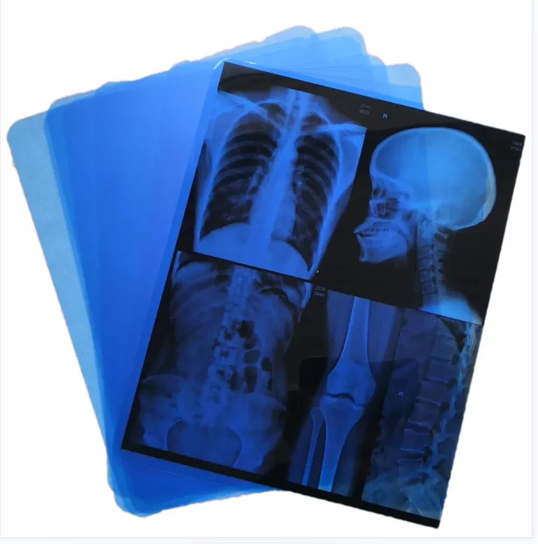 Medical Imaging film dry imaging prosess DICOM system for CT CR MRI used with FUJI Drypix lite or other dry printers