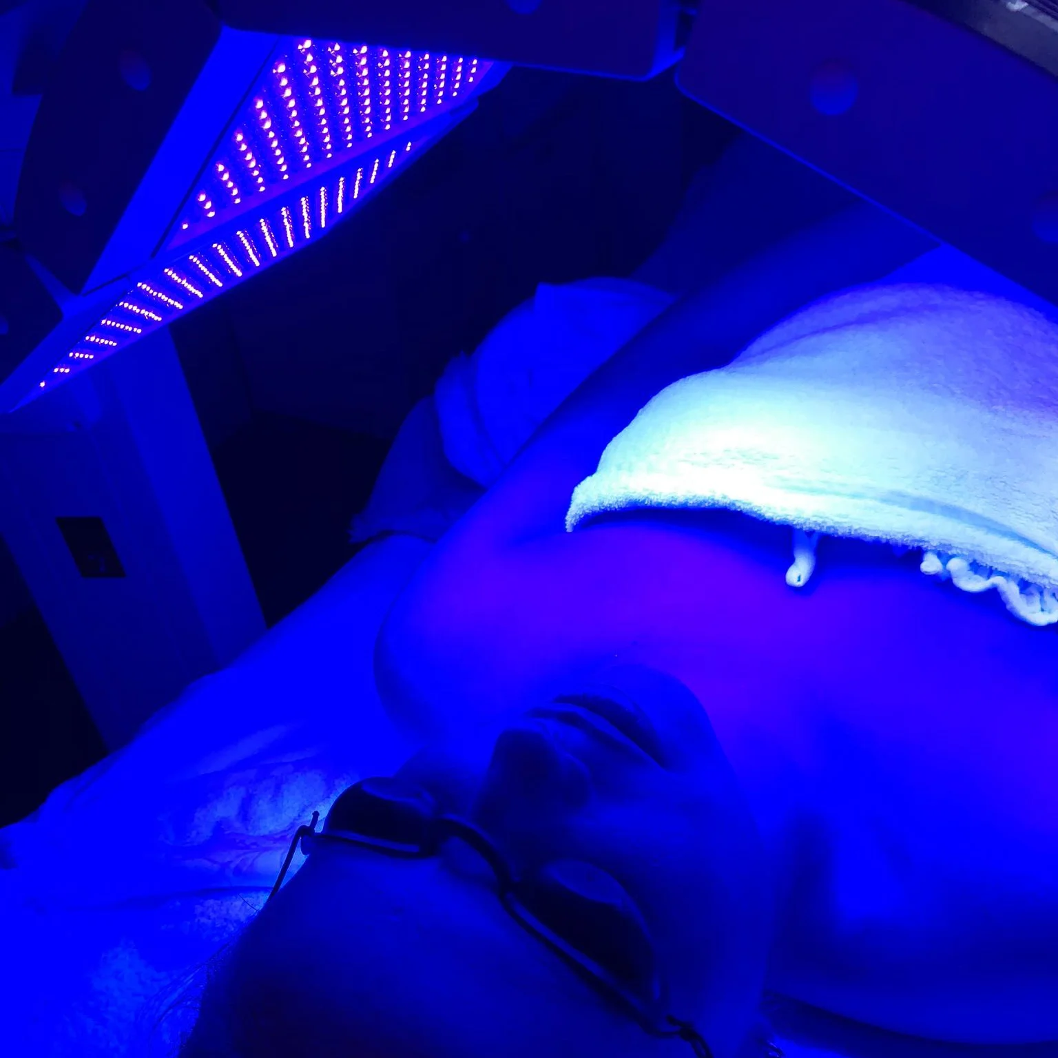 Laser Beauty Equipment Original Supplier Blue Light Therapy Devices for Acne Treatment