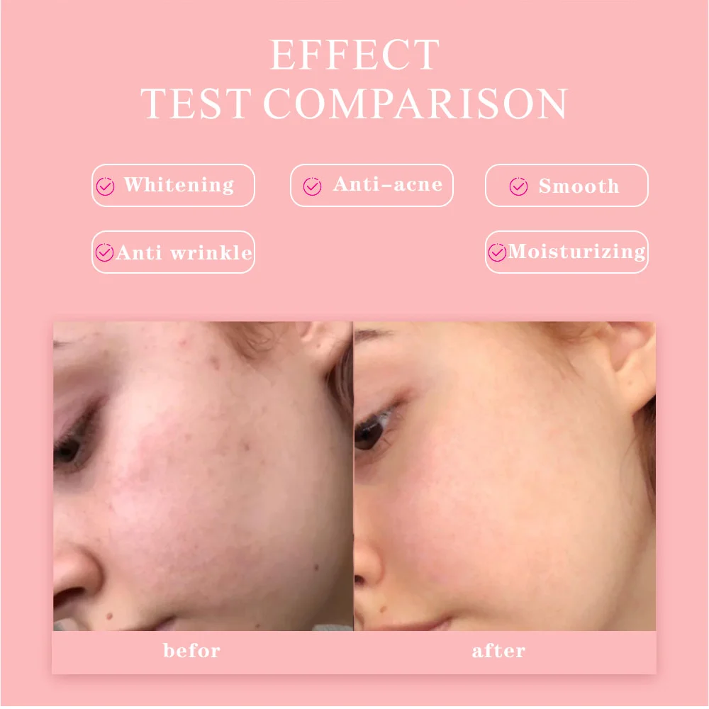 Wholesale Skin Care Hyaluronic Acid Niacinamide Vitamin C E Skincare Anti Aging Face Serum Facial Whitening 5 In 1 Serum