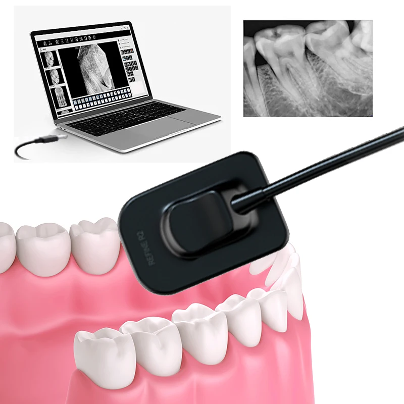 Refine HD Image Dental Intraoral Digital Xray Radiography Sensor System Portable Digital Dental RVG X Ray Sensor