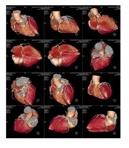 11X14inch High definition medical white film that can be viewed directly No need for film viewing lights  for PANTUM Printer