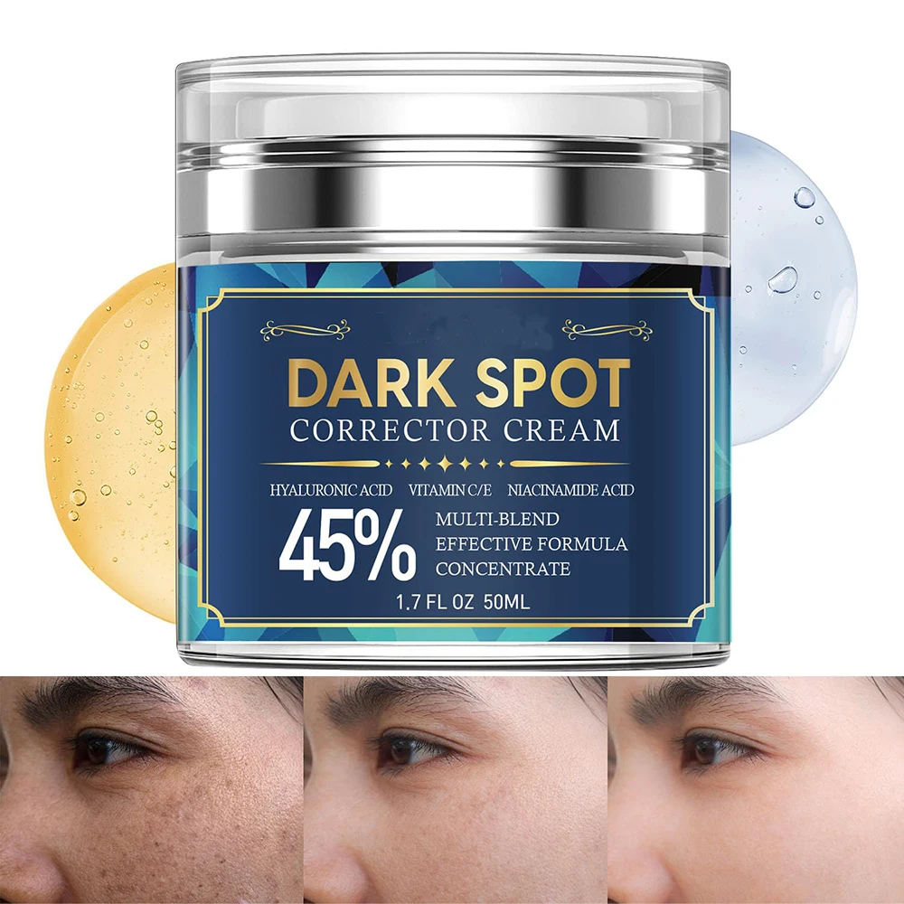 Black Spot Removal Cream is suitable for removing pigmented spots on the face body armpits knees head and sensitive areas
