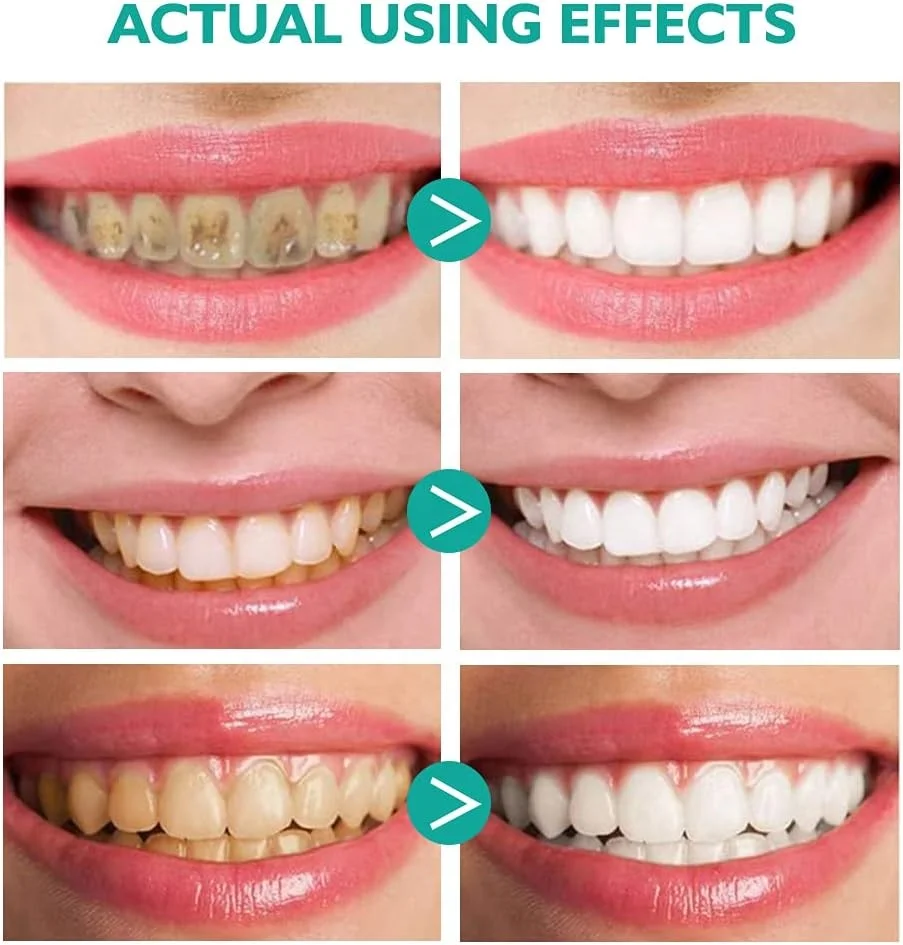 OEM ODM Calculus Removal Teeth Whitening Healing Mouth Ulcers Eliminating Bad Breath Mouthwash Tooth Regeneration Mousse