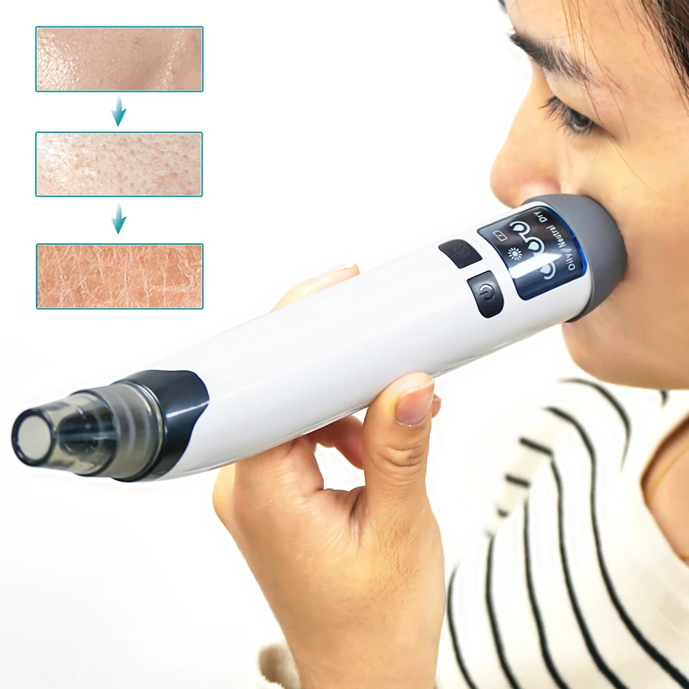 Hot Electric Pimple Removal Suction Extractor Tool Kit Heated Vacuum Blackhead Remover Face Pore Cleaner