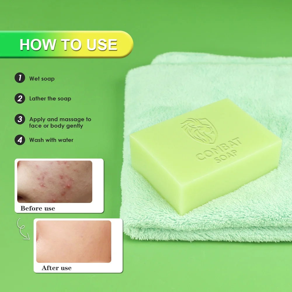 Factory Charcoal Combat Anti Acne Organic Soap Bar Handmade Moisturizing Anti-inflammatory Hand Made Soap Manufacture