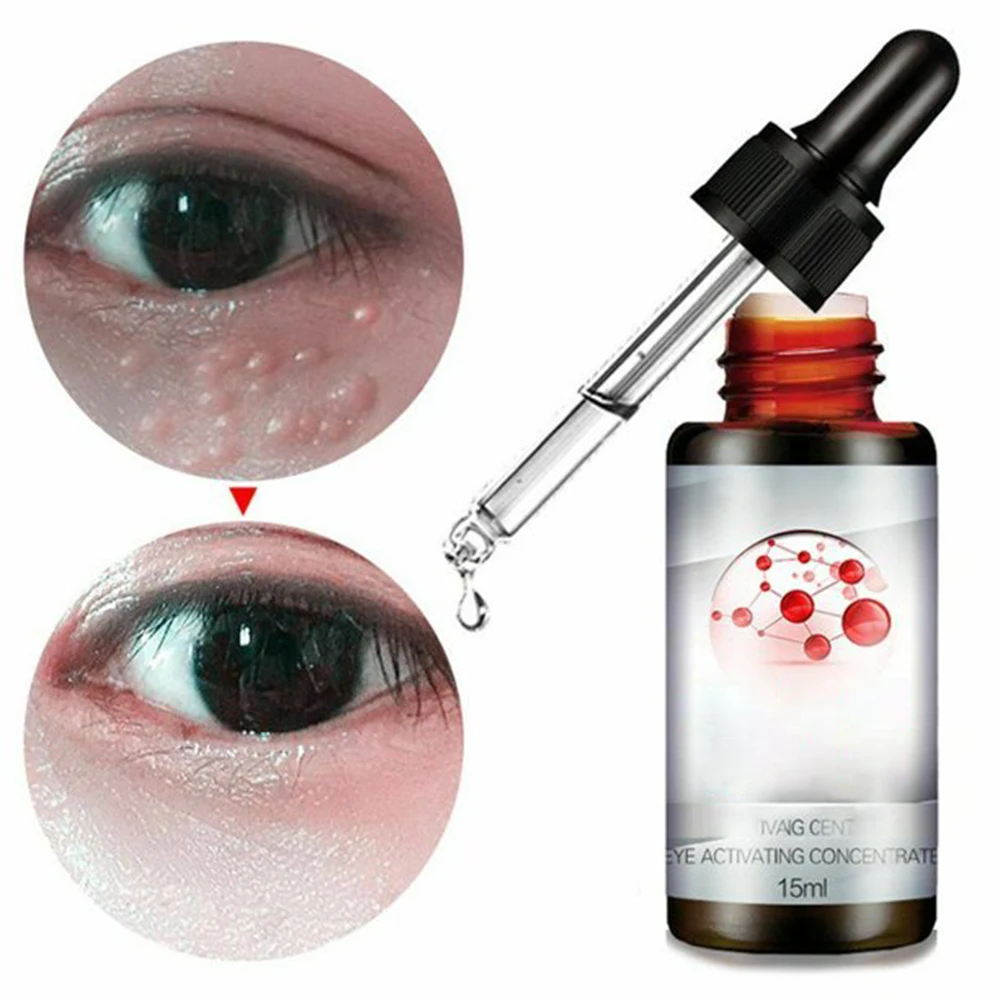 OEM ODM Supply Anti Wrinkle Dark Circles Puffiness Eye Serum For Cosmetic