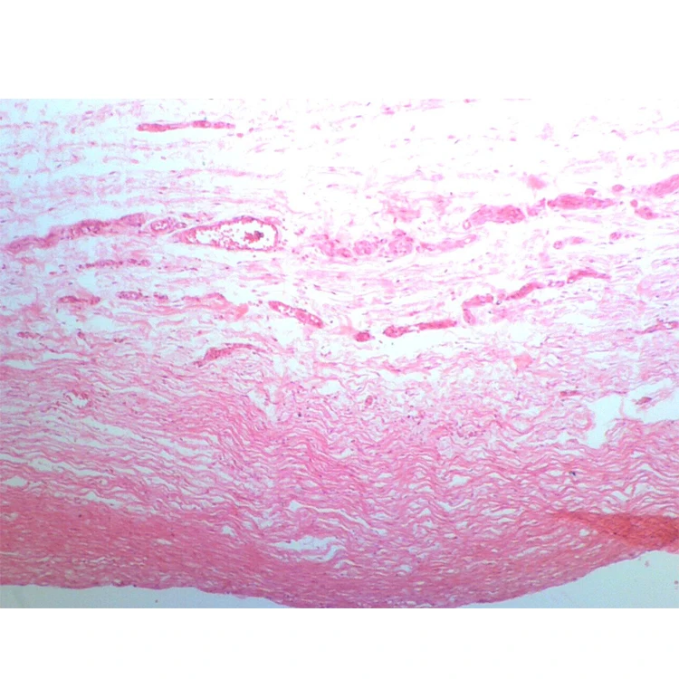 School and Medical Hot Sale Human Chromosome microscope prepared slides