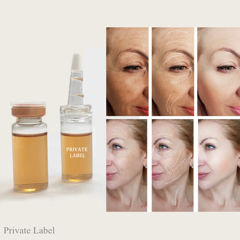 OEM Meso Serum Kit Hyaluronic Acid Anti Wrinkle Removal Skin Whitening Meso Therapy Serum Repair Serum