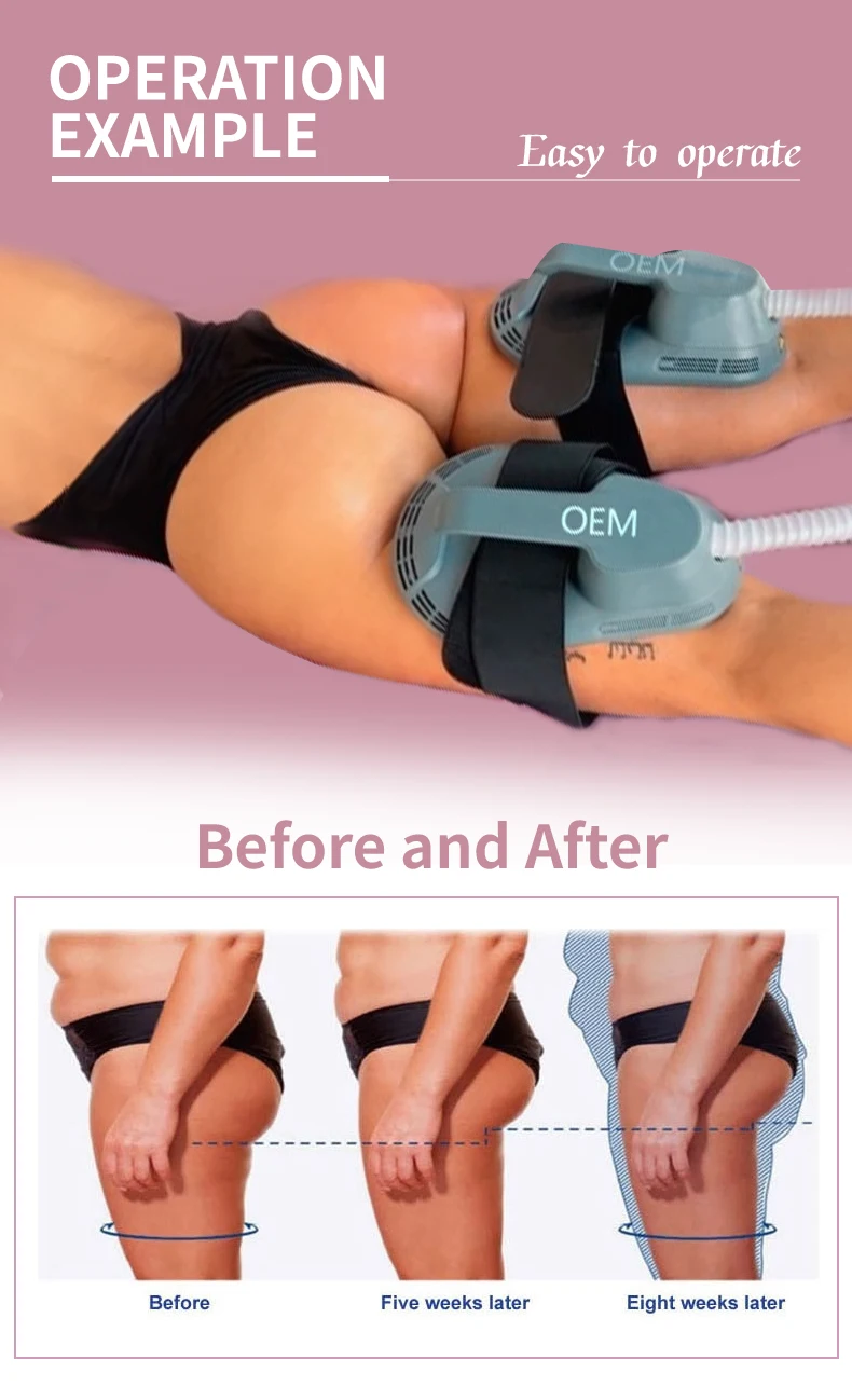 Portable machine 4 or 5 Handles muscle building hip lift Neo zero Muscle Stimulator weight loss Ems Body sculpting