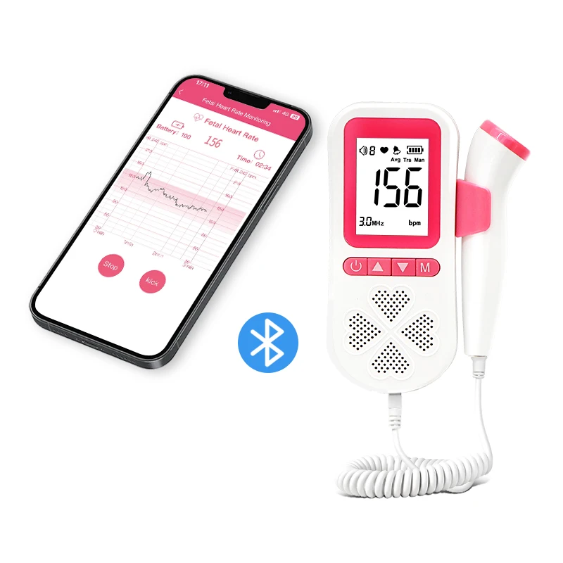 Remote Telehealth Record and Share Baby Heartbeat Monitor Fetal Doppler with App Mobile Phone Bluetooth Connect