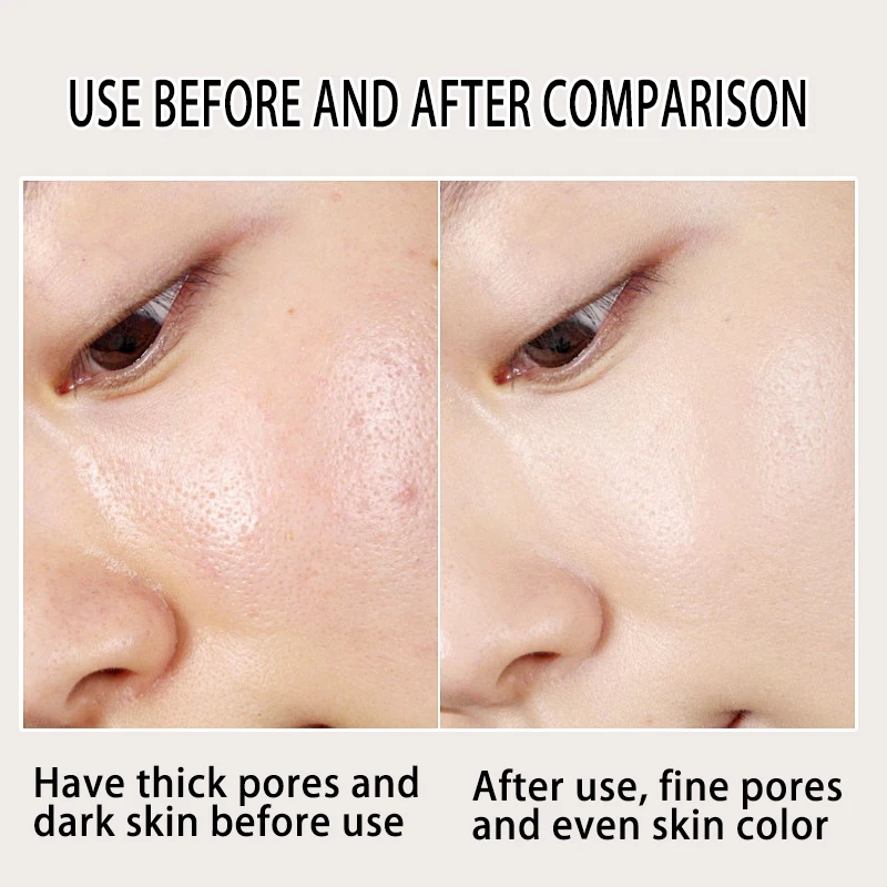 Alcohol-Free Rose Petal Witch Hazel Facial Toner Glowing Skin Soothing Hydrating Refresh Toner For Normal And Combination Skin