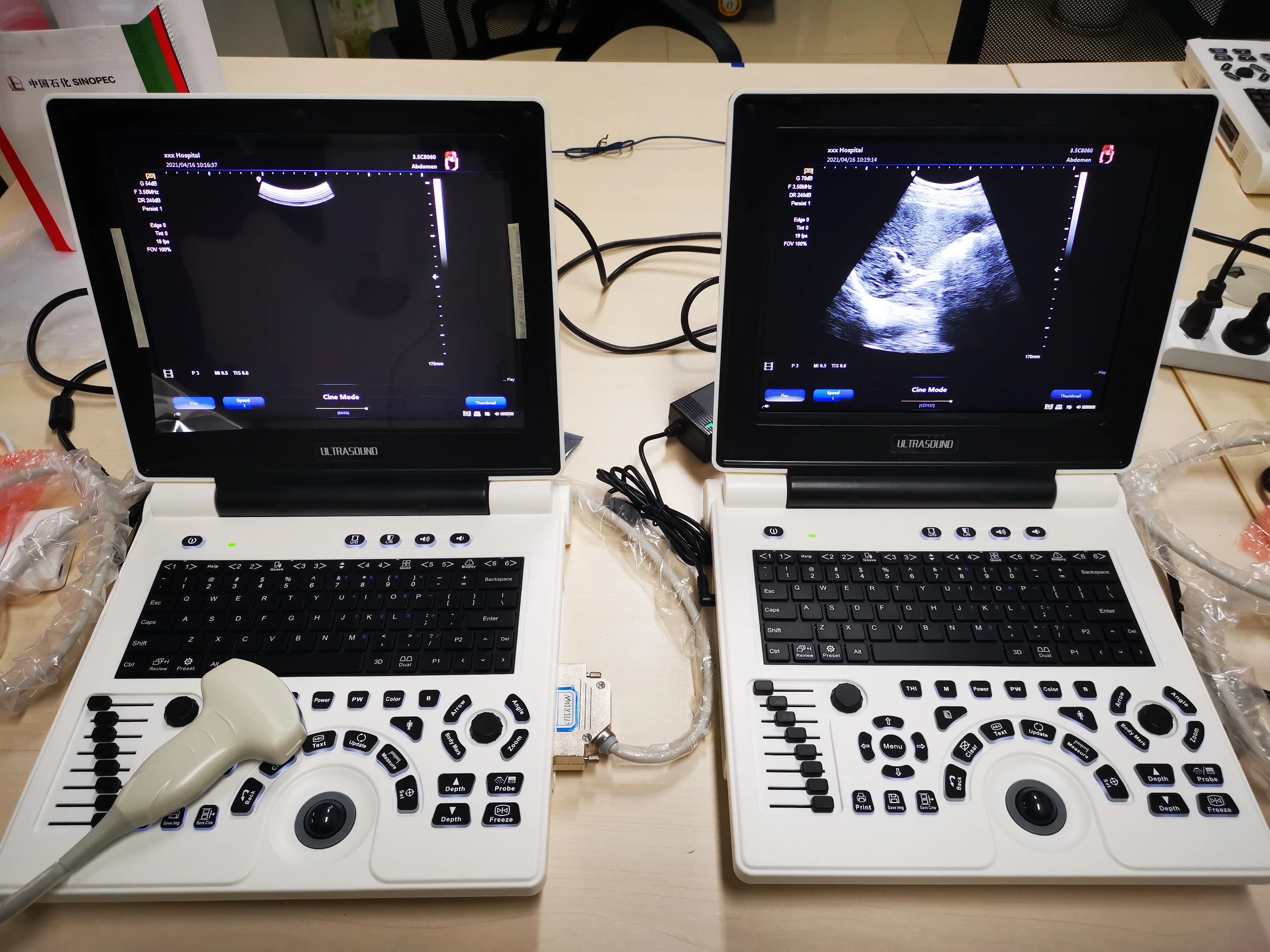 Medical Diagnostic B&W Portable Ultrasound Machine Ultrasound Scanner For Sale