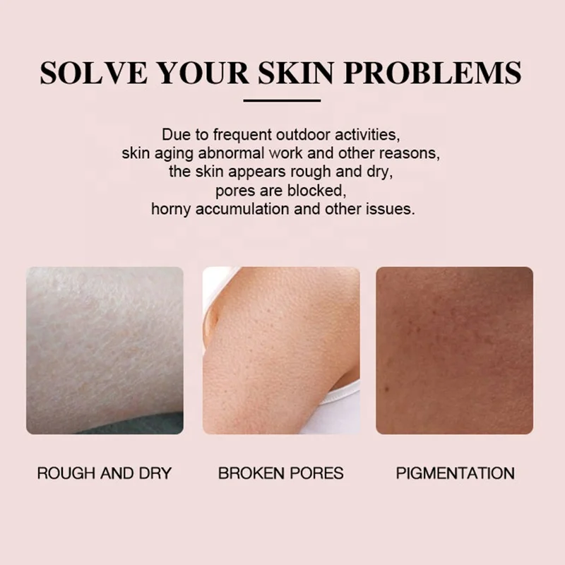 Private Label Organic Shea Butter Sugar Stretch Marks Bath And Works Coco Hydrating Exfoliating Salt Shea Sugar Body Scrub