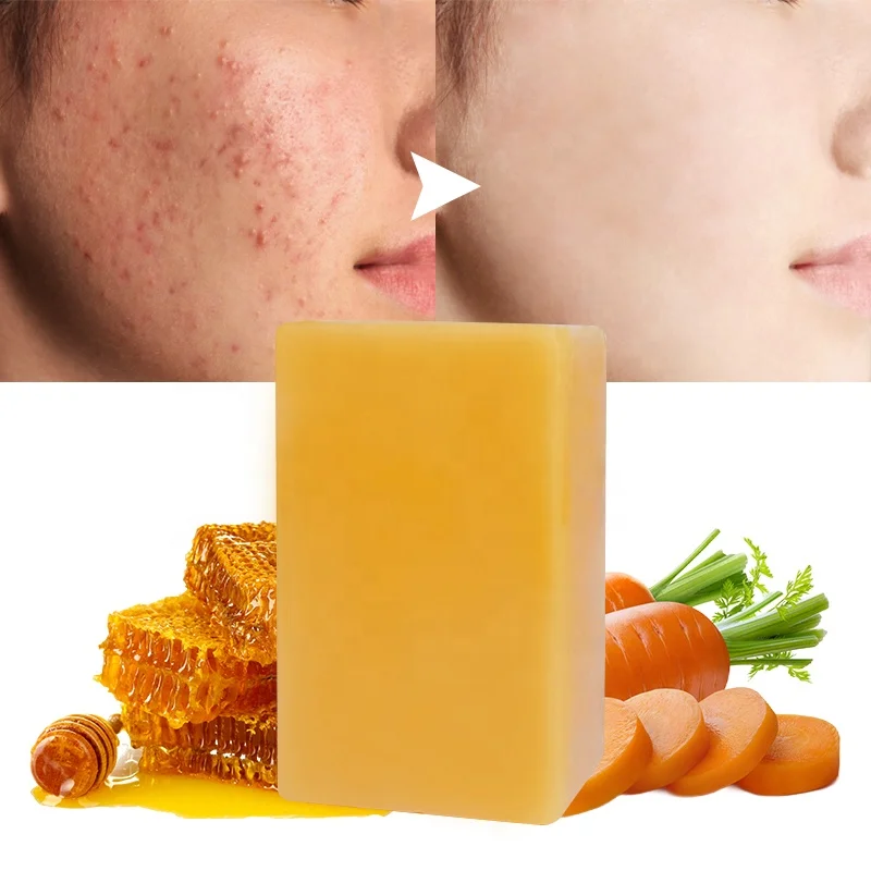 Natural Handmade Sabun Antioxidant And Acne Treatment Nutritious Carrot & Honey Complexion Soap Bars