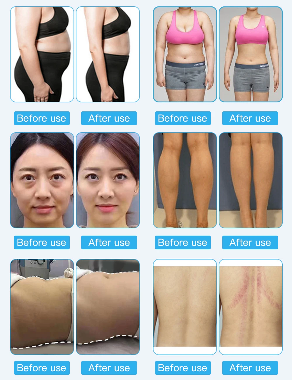 6 in 1 80K cavitati0n Home Use Beauty Equipment Multi Functional ultras0nic Machine with EMS pad