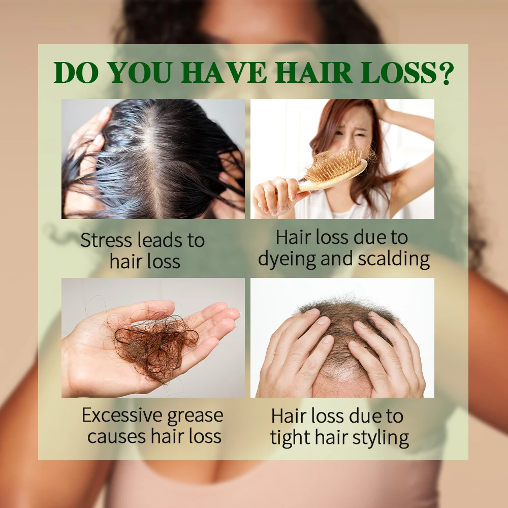 Фирменная оптовая продажа натуральной органической кожи головы средство для ухода за волосами черного цвета против выпадения имбирное масло роста волос сыворотка