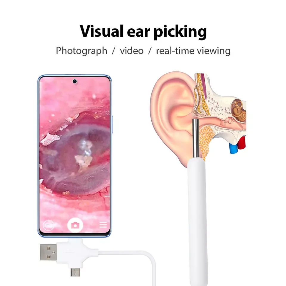 Factory Hot Seller 3 In 1 Usb Visual Otoscope Camera Hd Ear Wax Removal Cleaning Tool Ear Endoscope