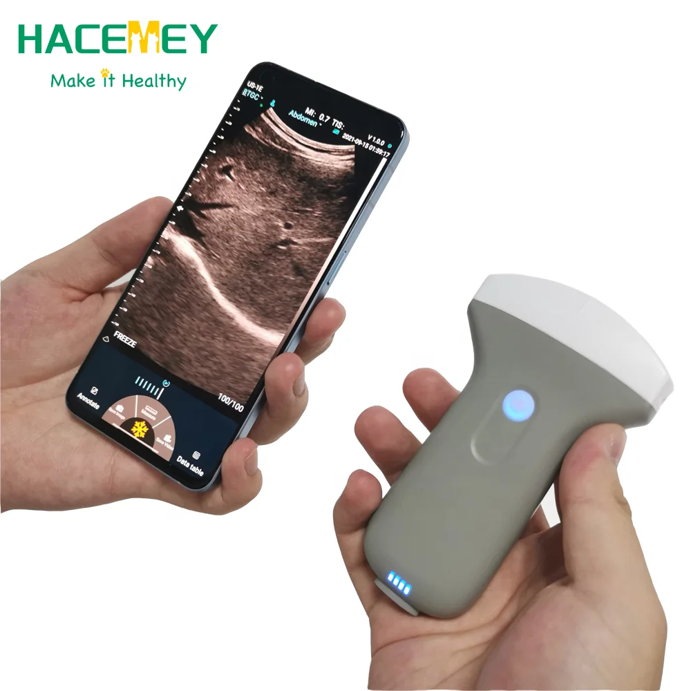 HACEMEY Pet Wireless Ultrasound Scanner Handheld Animal Pregnancy Ultrasound Machine Mini Colour Doppler Ultrasound