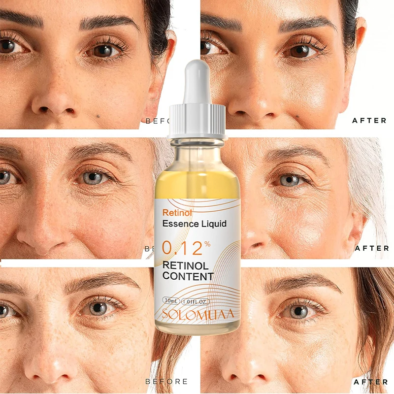 Factory Hyaluronic acid skin maintenance wrinkle serum retinol correxion deep retinol serum with hyaluronic acid and collagen