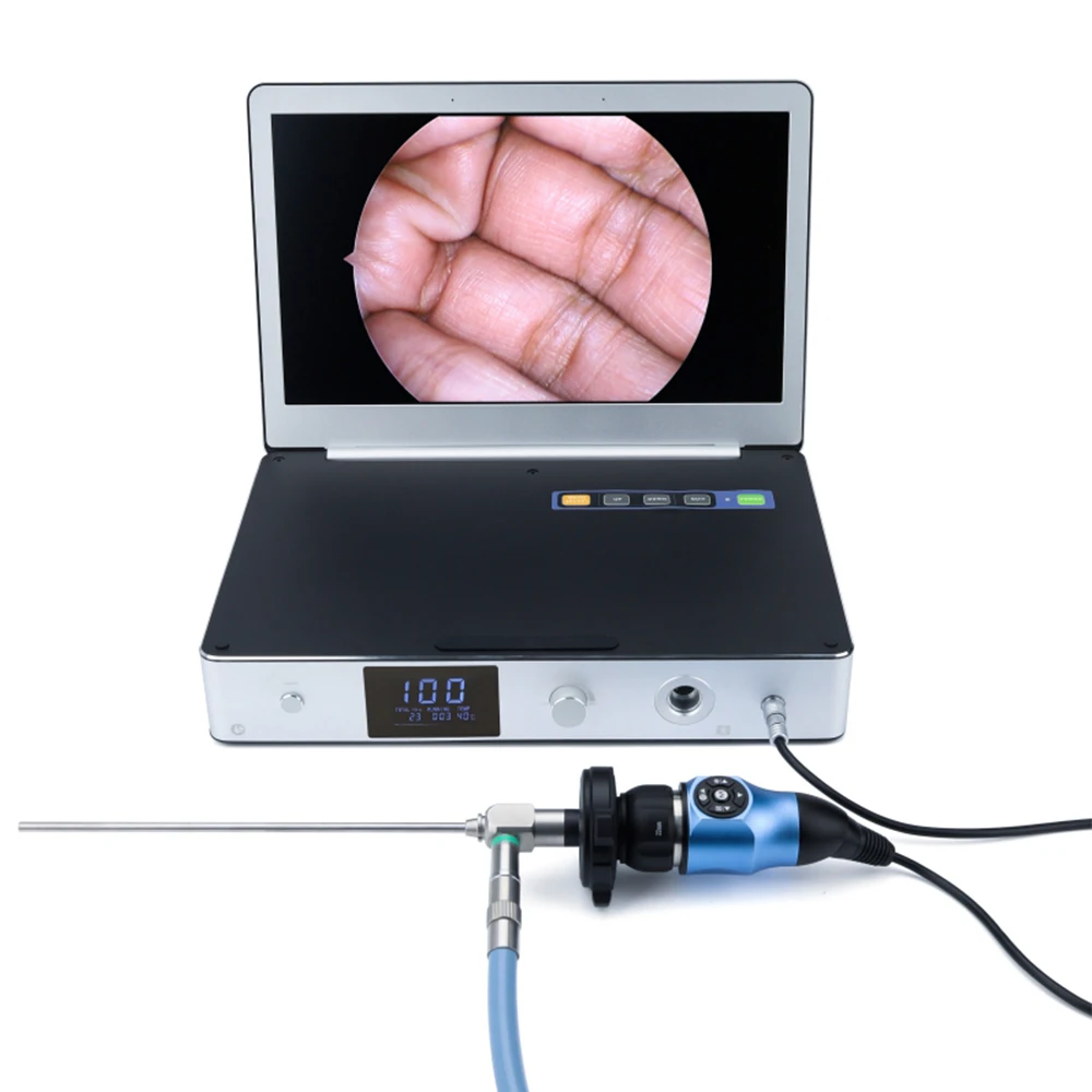 Full Hd 1080p 11.6 Laptop Endoscope Camera For Orthopedics