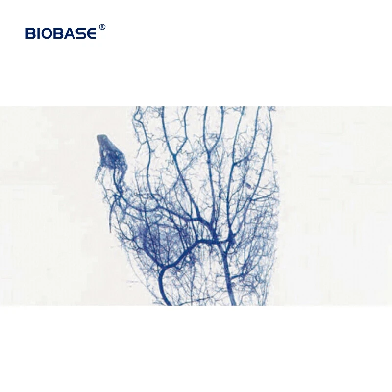 biobase Vein Finder X Ray Film Viewer Clinically Proven Vein Finders for IV Access for hospital