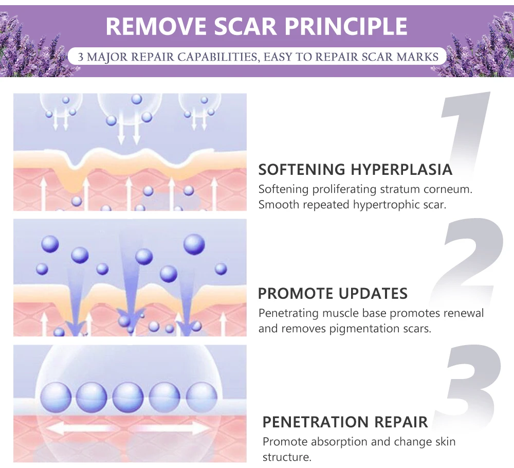 Body Face Skin Care Remove Pregnancy Scars Acne Surgical Burn Scar Removal Cream