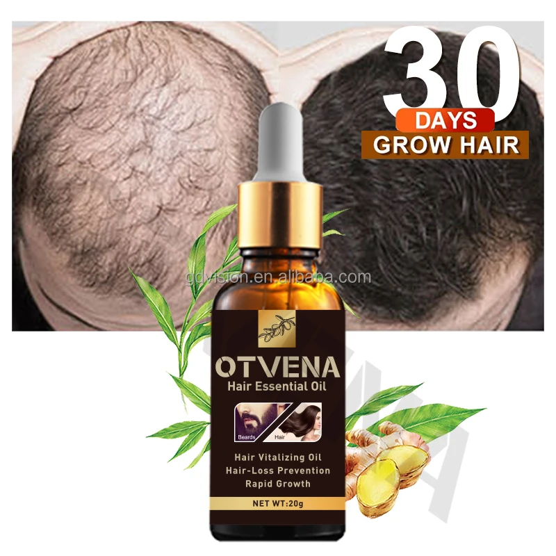 Private Label Organic Anti-Hair Loss Treatment Regrowth Black Seed Extract Thicken Hair Growth Oil Serum Spray