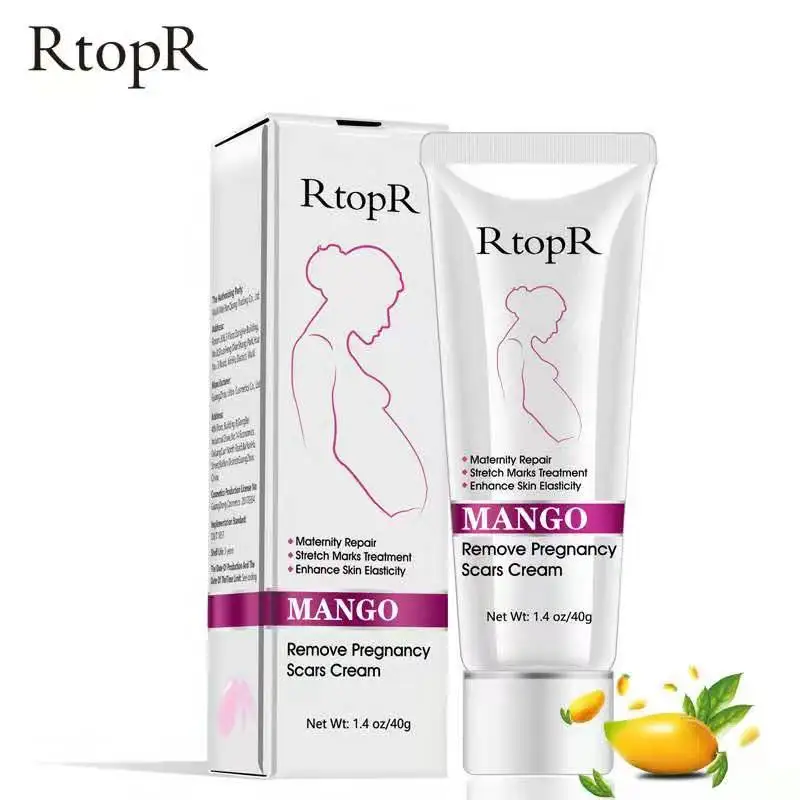 Mango Remove Pregnancy Scars Acne Cream Stretch Marks Treatment Maternity Repair Anti-Aging Anti Winkles Firming Body Cream