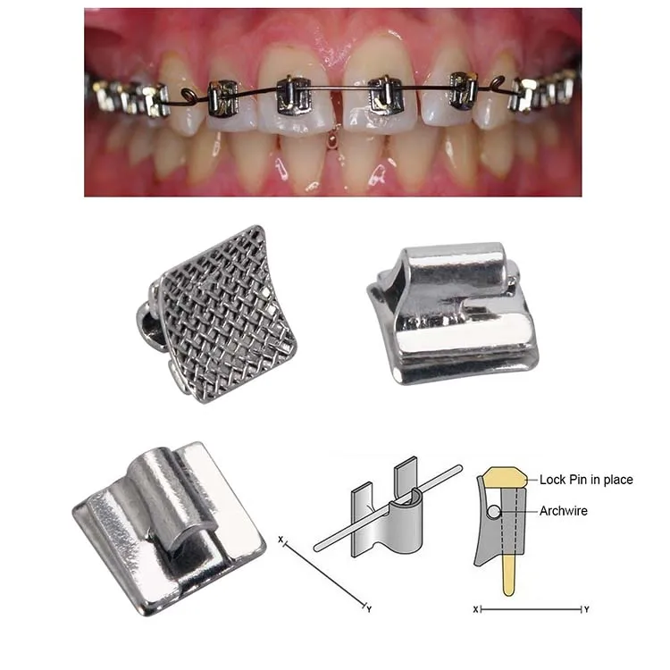 Dental Consumables Orthodontic Begg Bracket Begg Braces