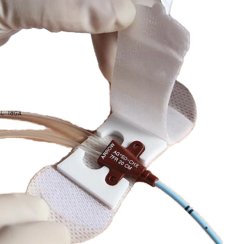 Медицинская поставка одноразовый нетканый катетер-фиксирующее устройство для гемодиализа Катетер Picc /CVC-катетер