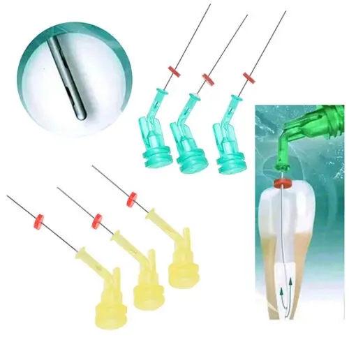 Dental disposable safe sterile pre-curved flushing Irrigation needle tip