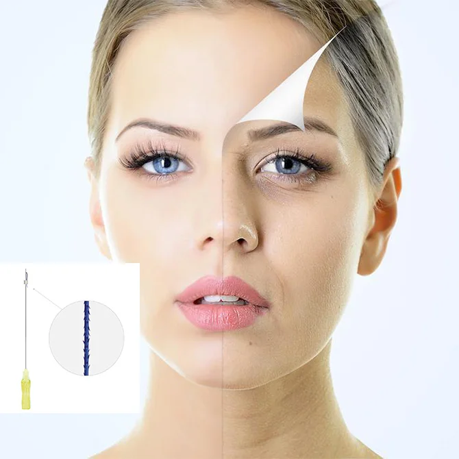 Для более прочной кожи PDO thread Eye 30 г 25