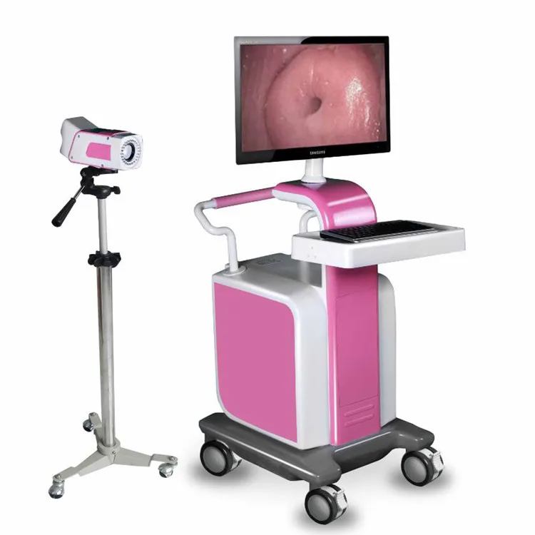YSSW3304 Ysenemd HD Specialized Digital Optical colposcope workstation mobile colposcope 4k colposcope for gynecology trolley