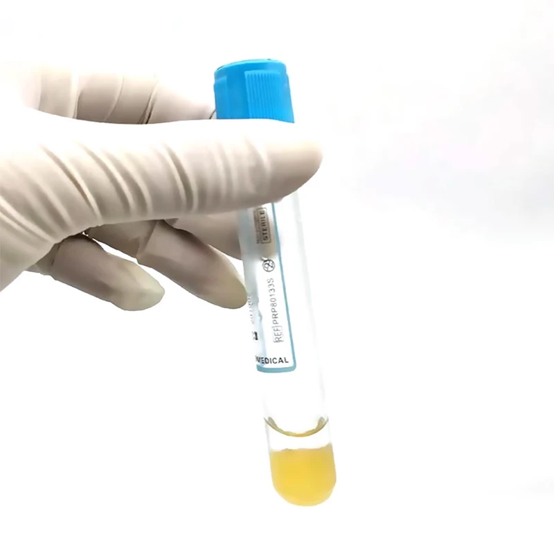 High Quality prp plasma tube kit gel 8ml 13ml vacuum blood collection tubes individual packaging prp tube 15 ml with gel