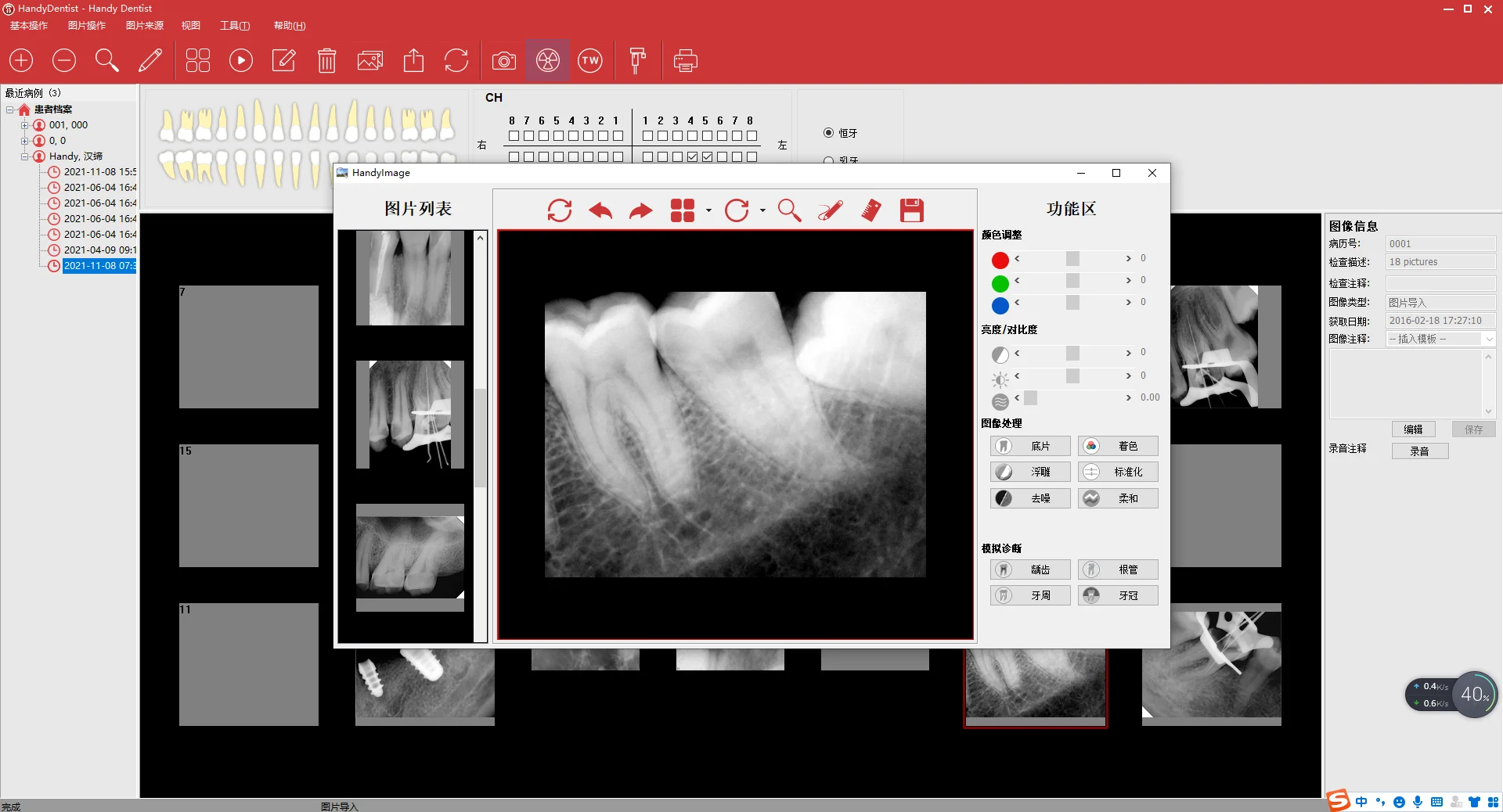 Digital imaging system radiography rvg sensor for clinic Dental X Ray Sensor Price