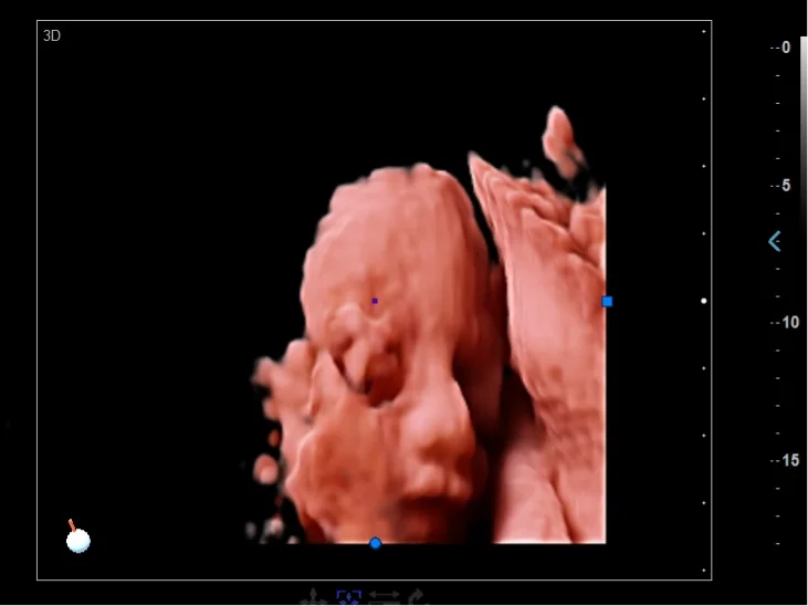 Обследование Ob Gyn цветной доплеровский медицинский ультразвуковой аппарат Sonoscape с 5D