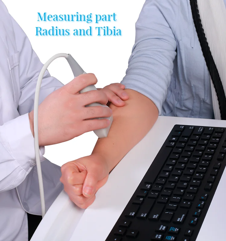 Clinical Application Professional Optional Printer Scan Whole Body Ultrasound Bone Density Tester Analyzer