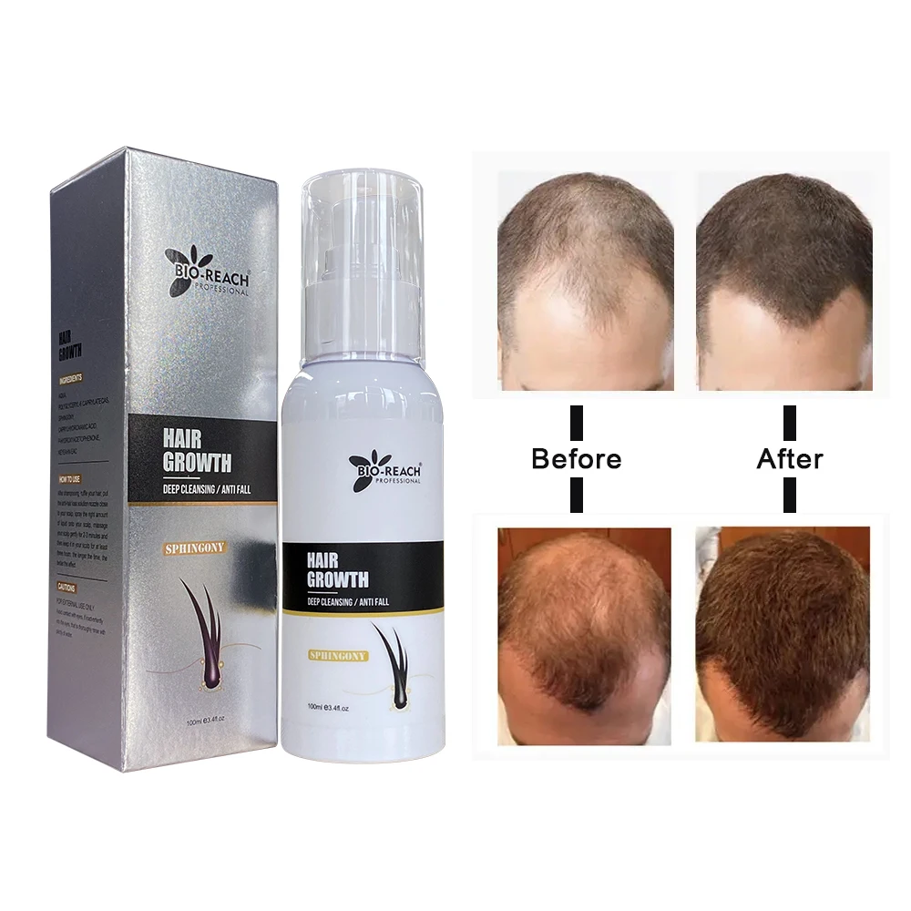 YOGI 100ml Organic Herbal Chinese Medicine Sphingosine Serum Hair Repair Serum