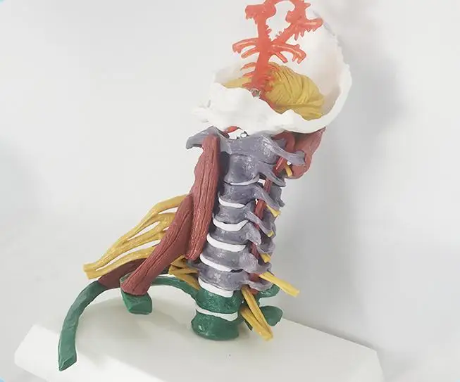 Life Size Colored Cervical Vertebra Model With Nerves and Muscles