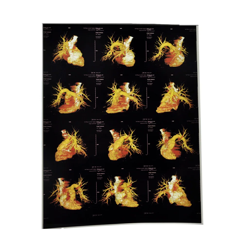 
Class I instrument classification medical radiology film for radiology endoscopic ultrasound 