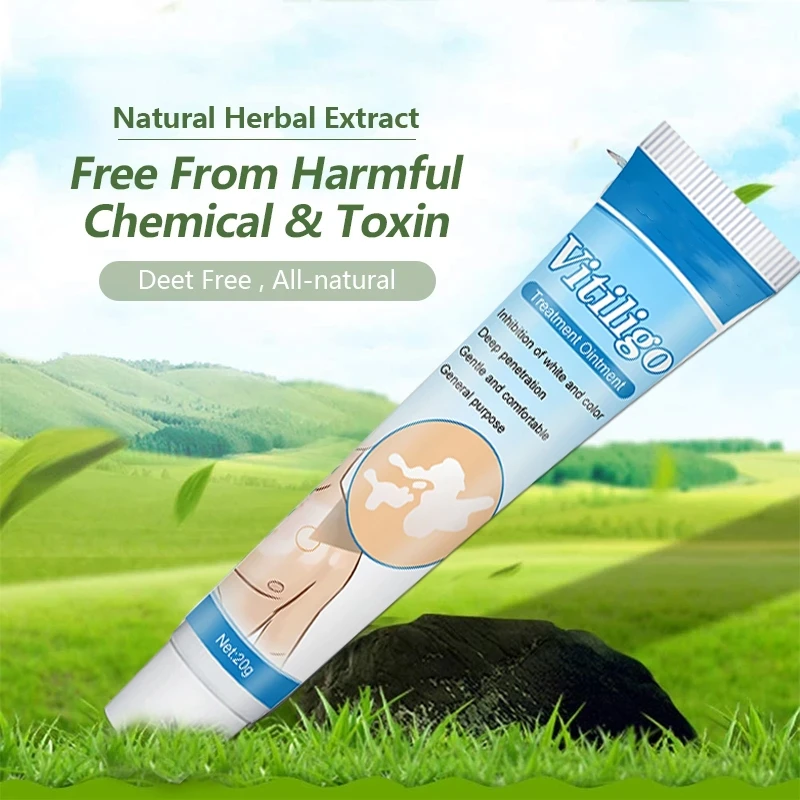 20g Herbal Extract Vitiligo Ointment Remove Ringworm White Spot Removal Skin Leukoplakia Disease Vitiligo Treatment Cream