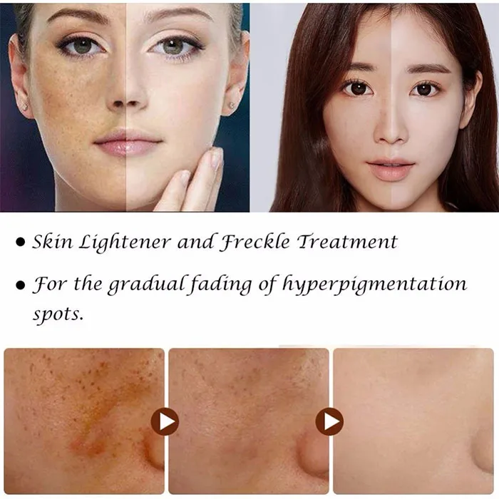 ODM OEM top selling chinese best day and night anti spot rapid white 7 days face skin whitening cream for women and men