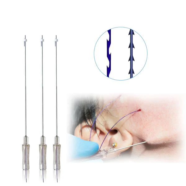 Thread Lifting Pdo Cog All Types Of Pdo Thread Lift Cog Threads 27g Pdo 3d 4d Cog