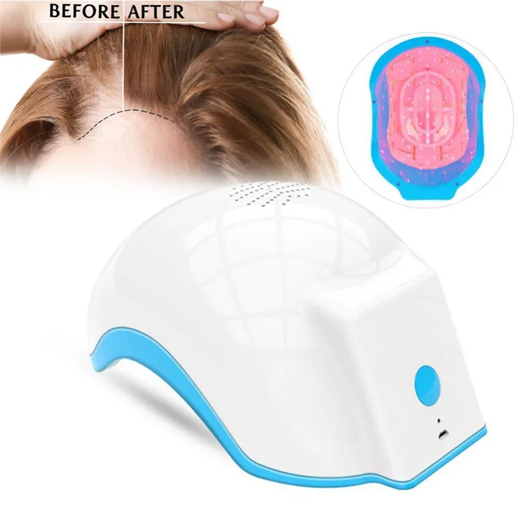 Hot sale hair loss treatment 80 Diode Laser Helmet laser hair growth cap