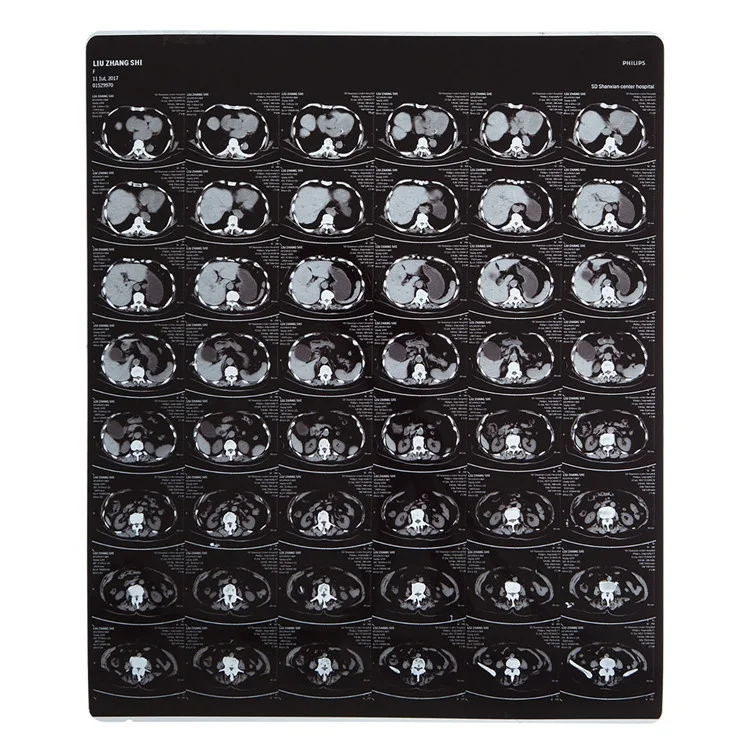 Beijing manufacture xray films for inkjet printer