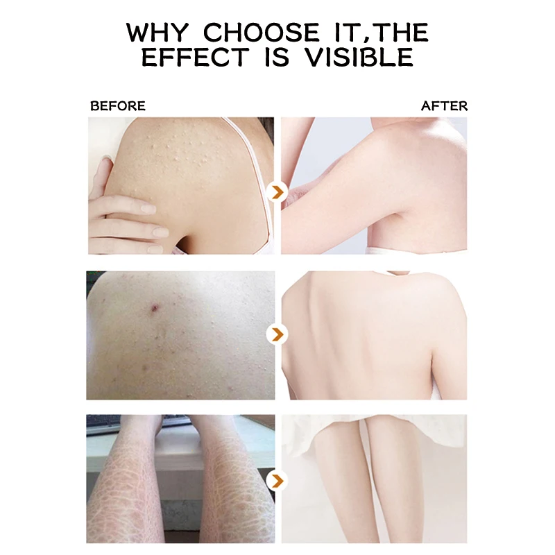 Remove Dead Skin Brighten Skin  Keep Moisture Balance Rose Ice Cream Scrub