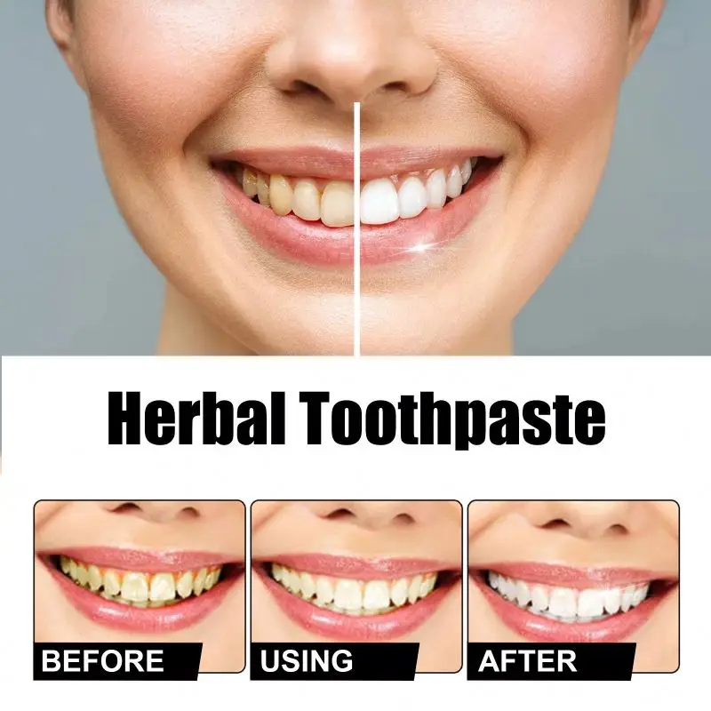 ORALHOE Oral Refreshing Whitening For Sensitive Teeth Natural Herbal Licorice Peppermint Aloe Vera Toothpaste 100ml